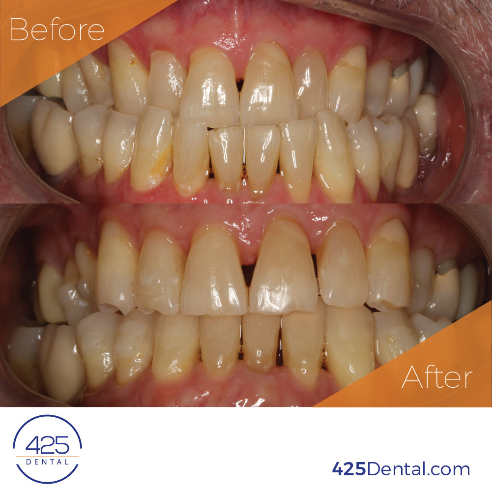 425 Dental Before After Campbell Tracy Facebook 01