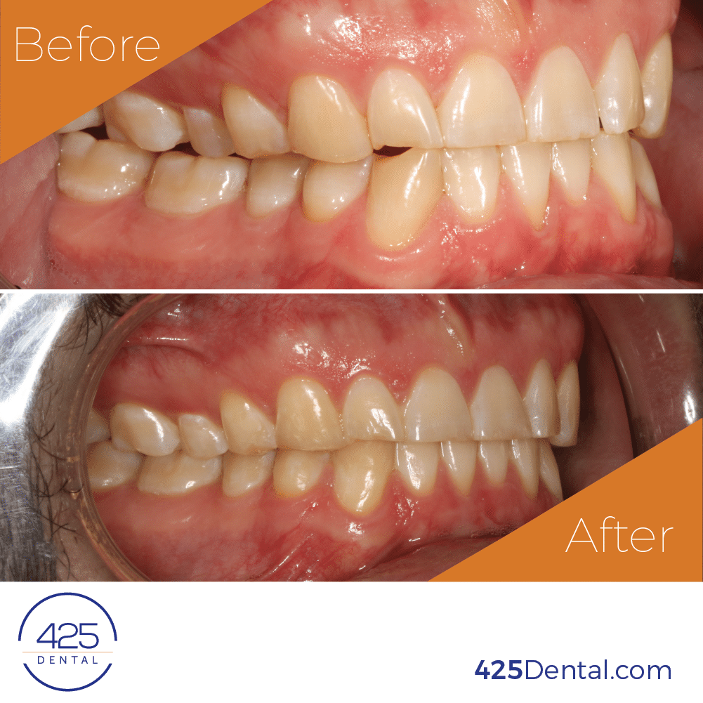 425 Dental Before After MSmith 01