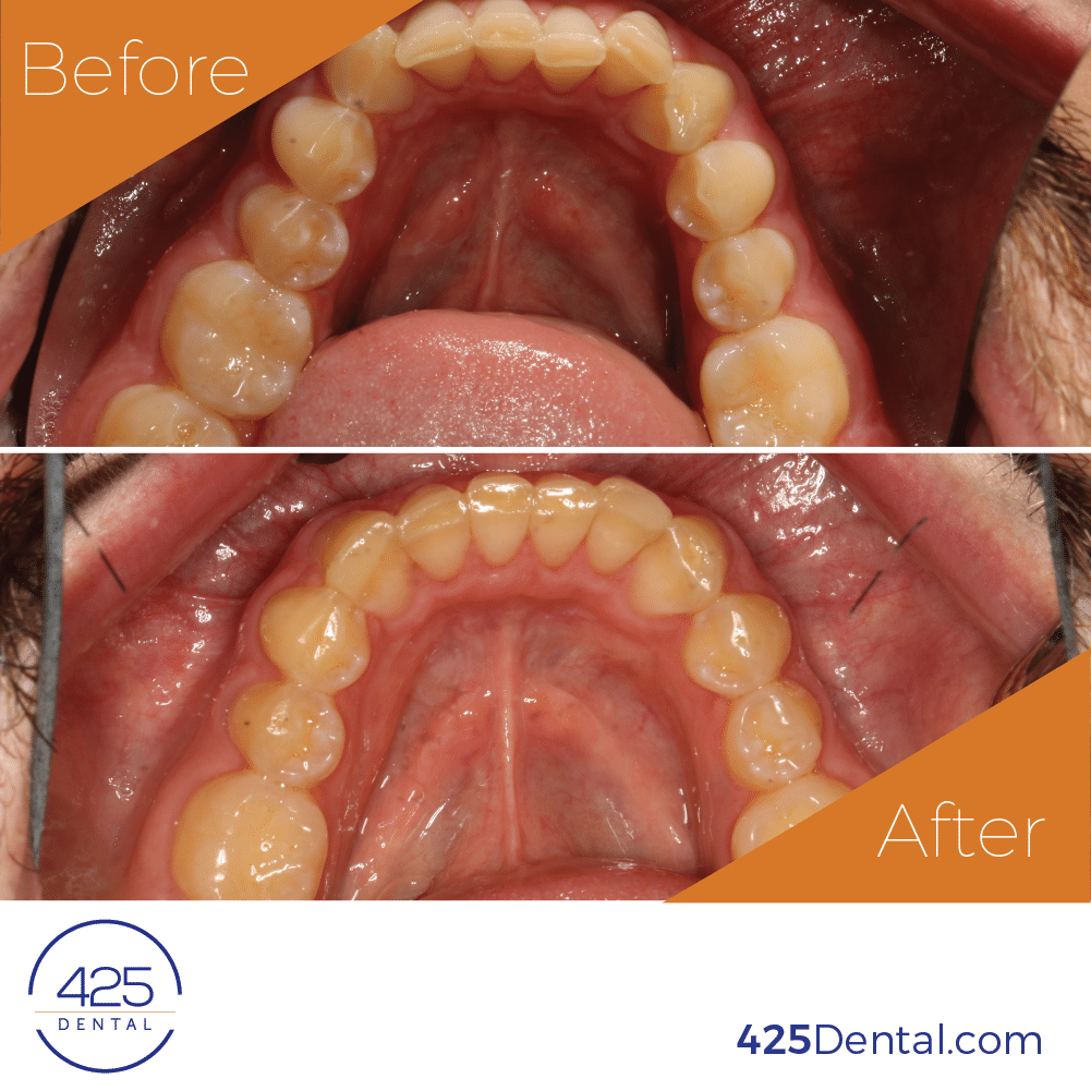 425 Dental Before After MSmith 02