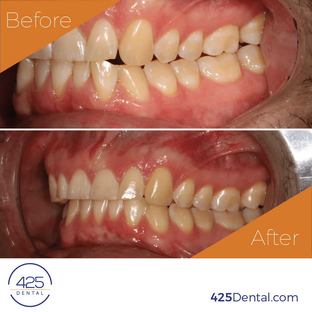 425 Dental Before After MSmith 03