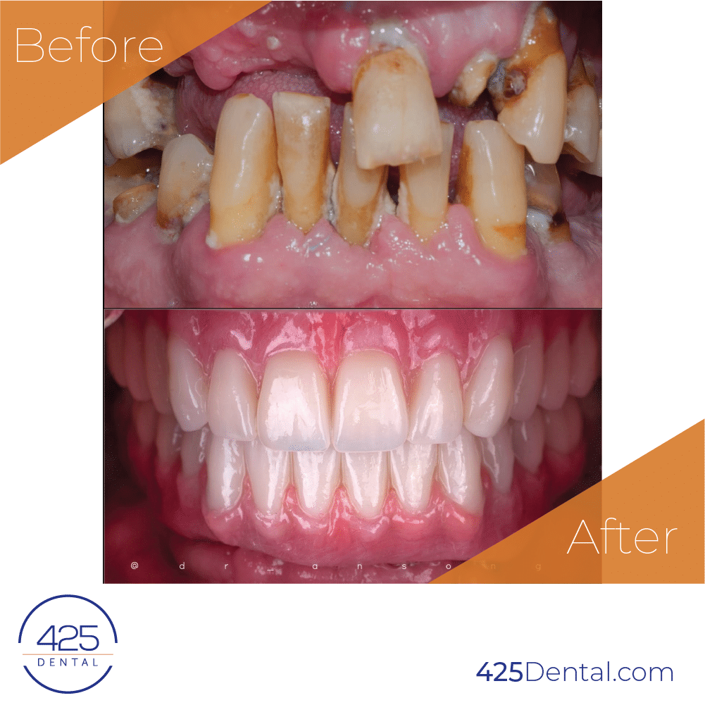 425 Dental BA Prosthodontics Artboard 14