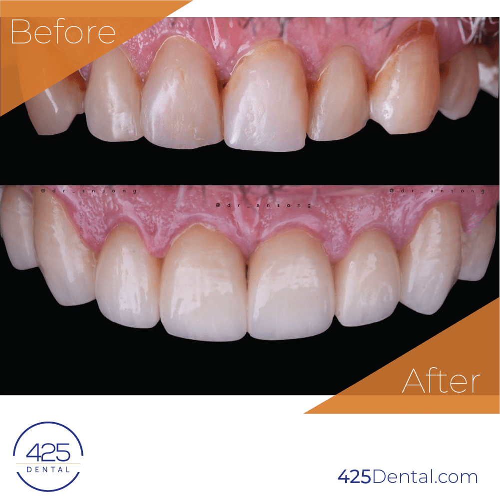 425 Dental BA Prosthodontics Artboard 19