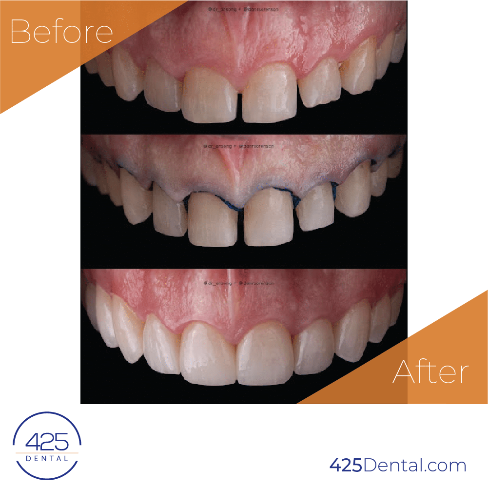 425 Dental BA Prosthodontics Artboard 4