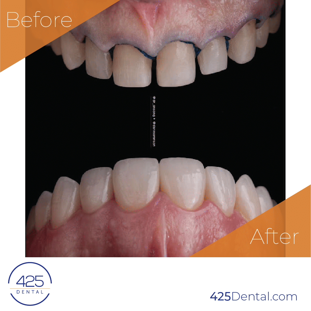 425 Dental BA Prosthodontics Artboard 9