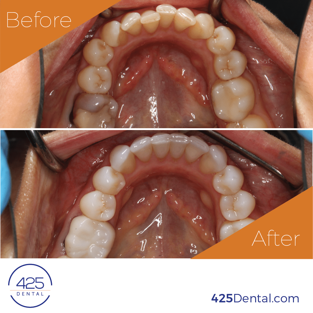 425 Dental Before After OAndreichenko 05