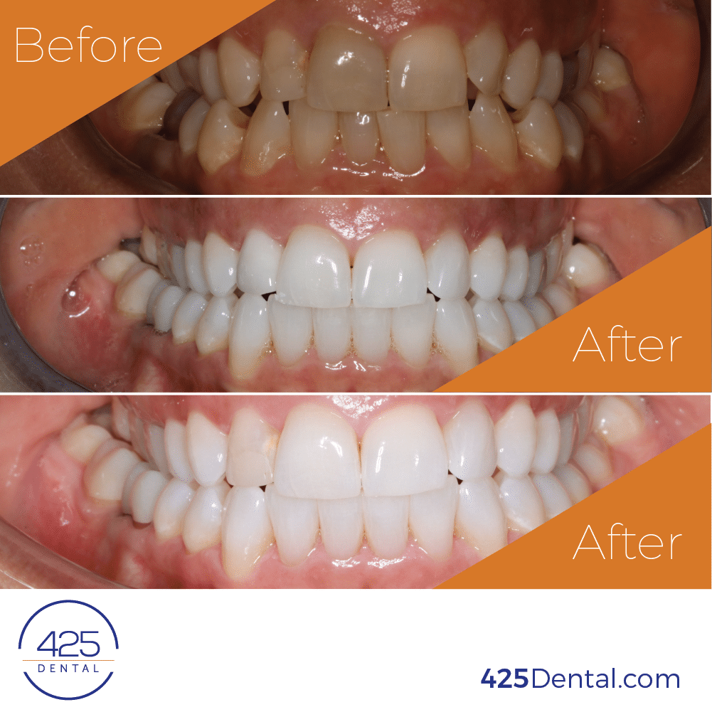 425 Dental Before After OAndreichenko 06