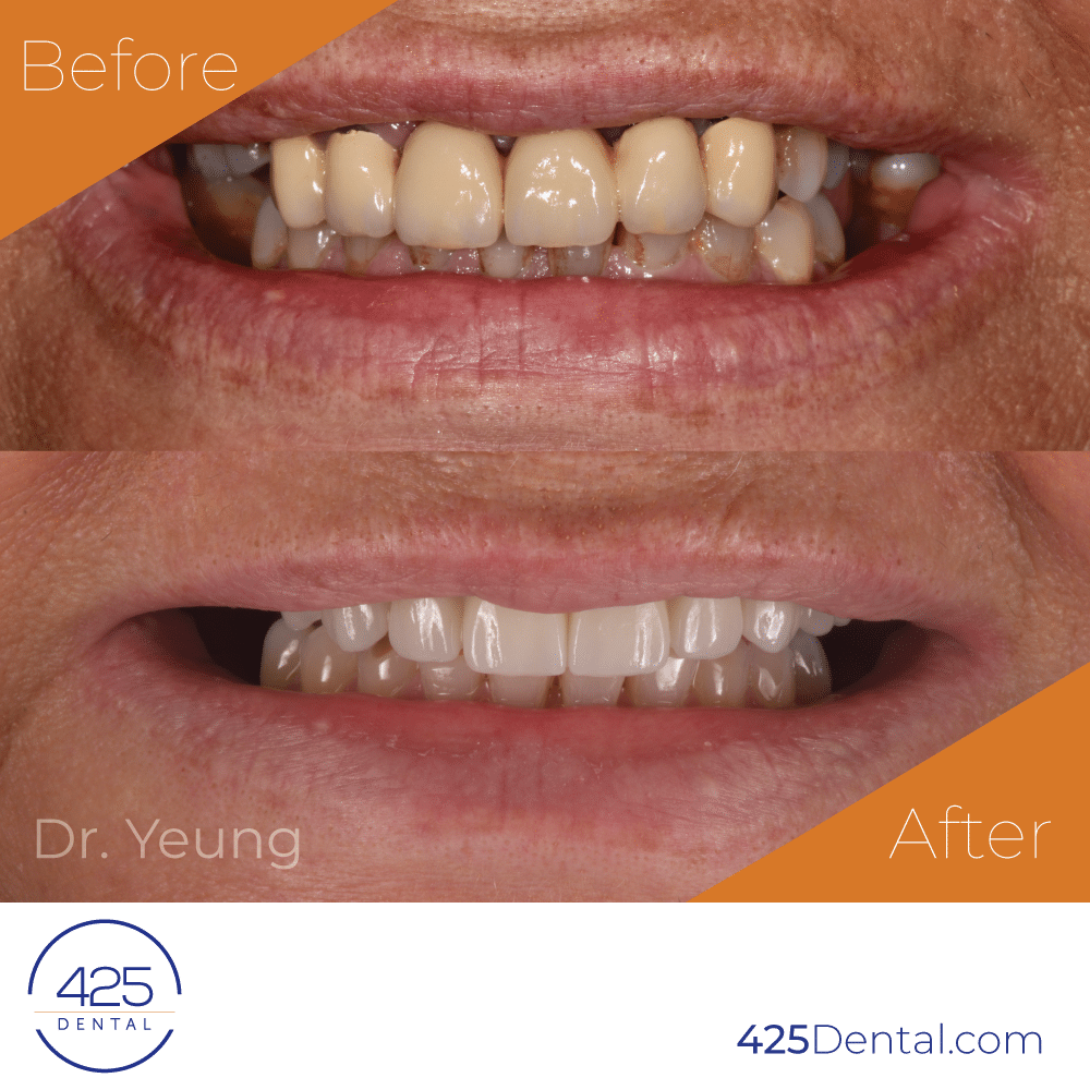 425 Dental Dr. Yeung Pros Cases_IG 1080x1080_ Mag 1